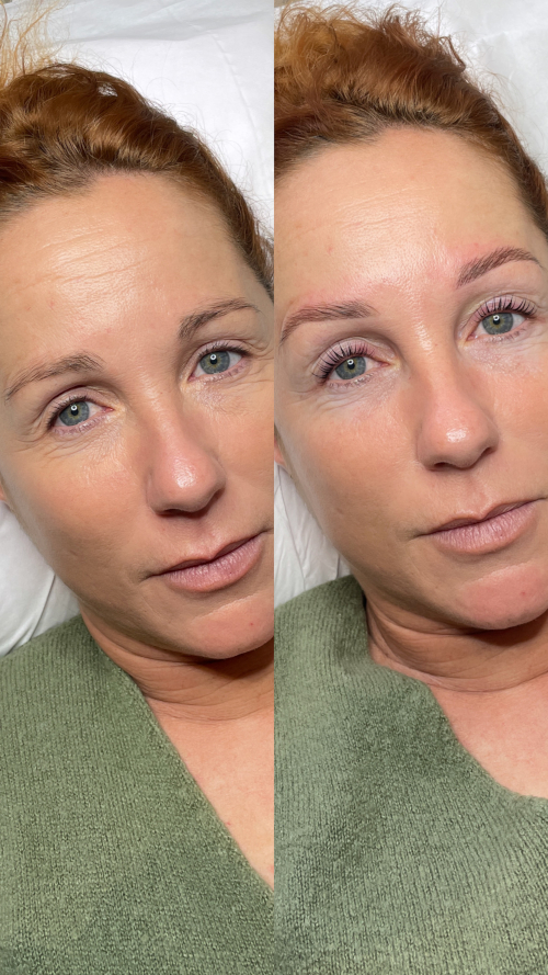 KoreanLashLift2