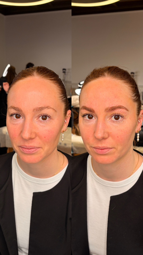 NanoBrows1