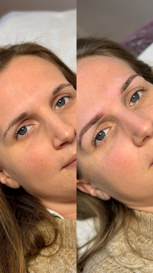 PigmentationMixte2