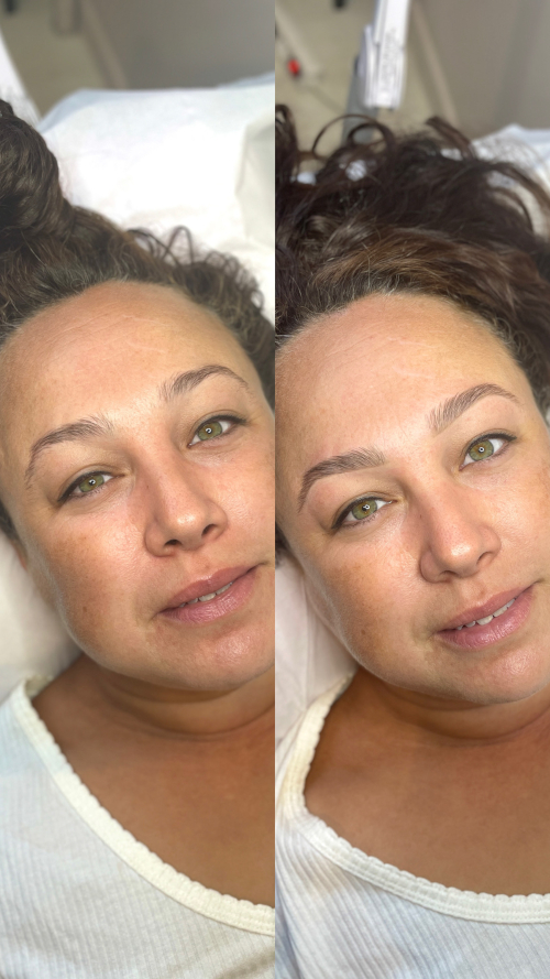 RestructurationEpilation1
