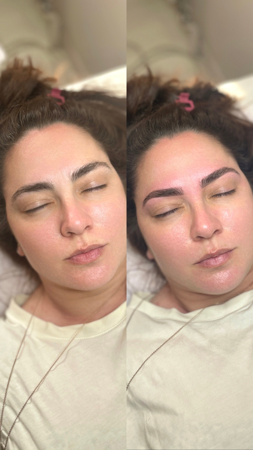 RestructurationEpilation2