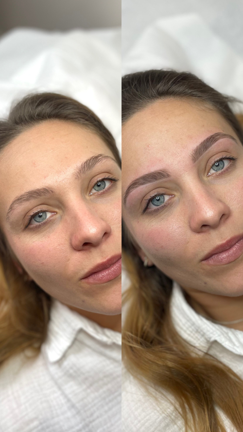 RestructurationEpilation3