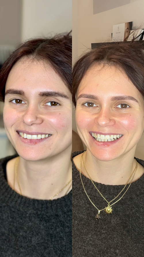 RestructurationEpilation4