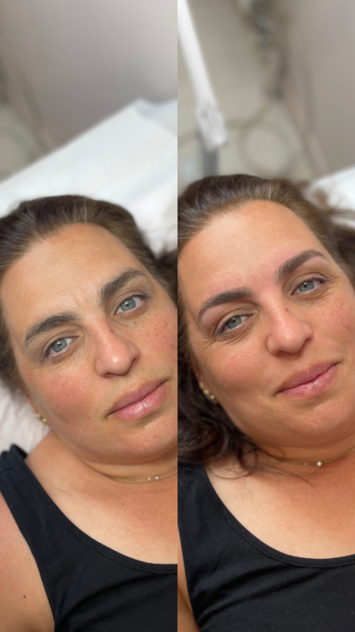 RestructurationEpilation7