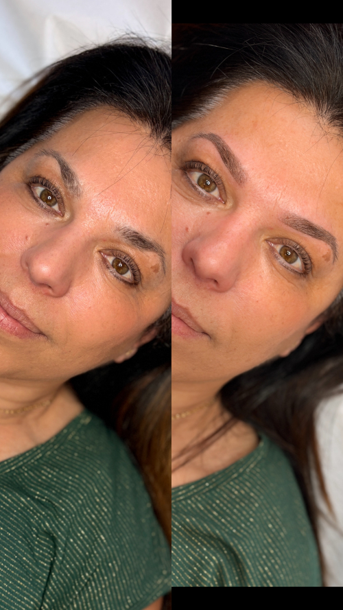 microshading10