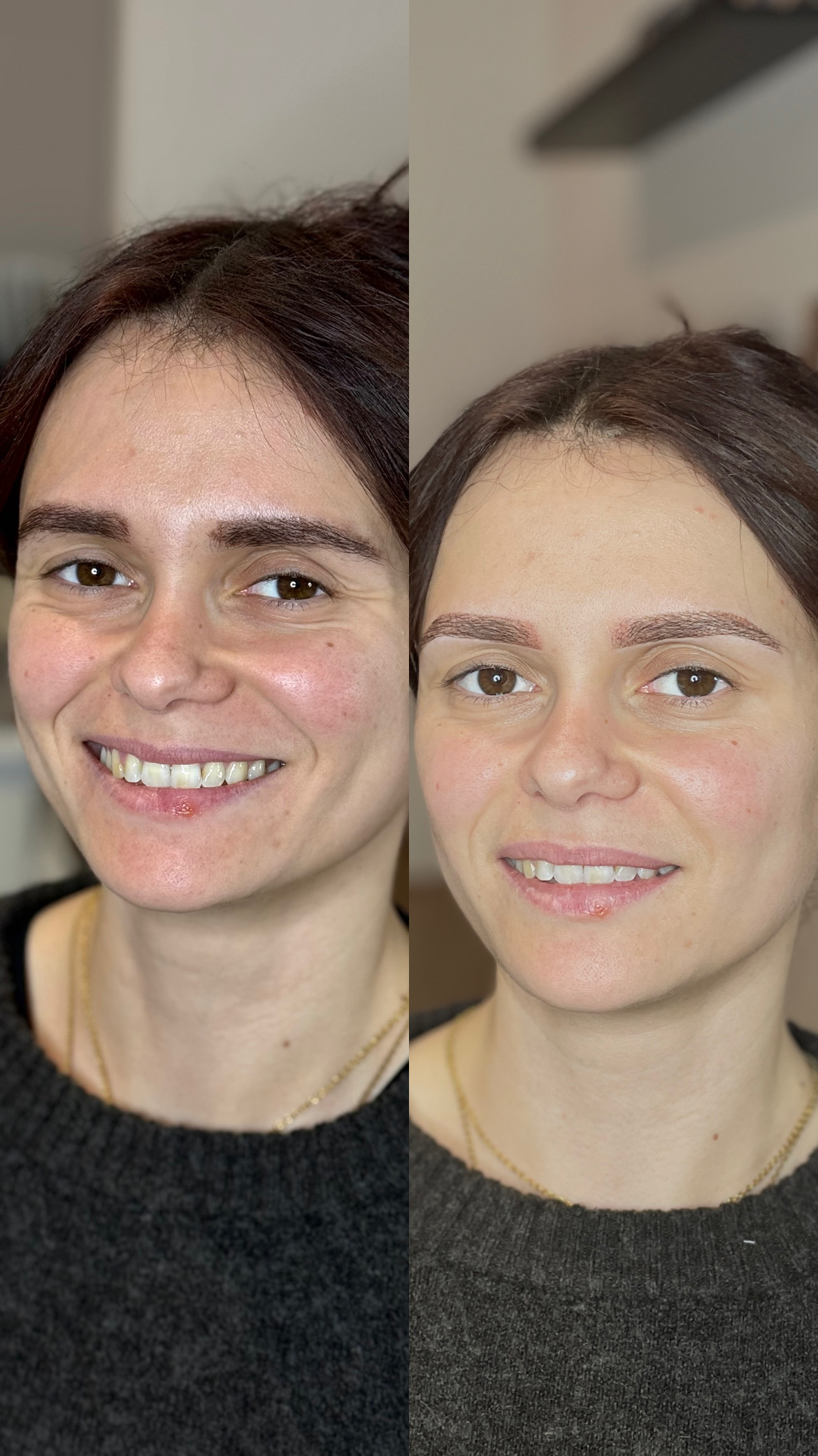 microshading3